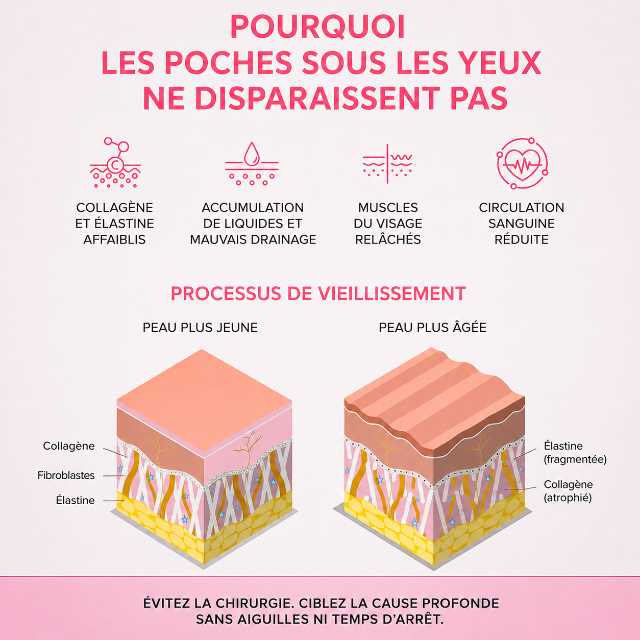 Pourquoi les poches sous les yeux ne disparaissent pas